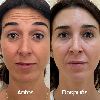 CREMA NIDA - Formula coreana para la piel arrugada 120ML