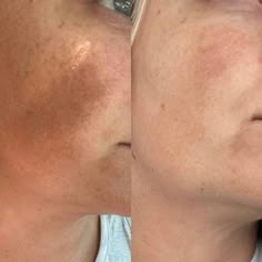 Arbutina Magic Skin – Despídete de las manchas en solo 3 semanas